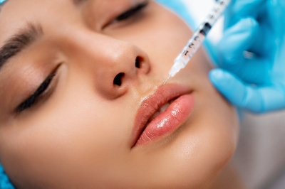 DERMAL FILLERS
